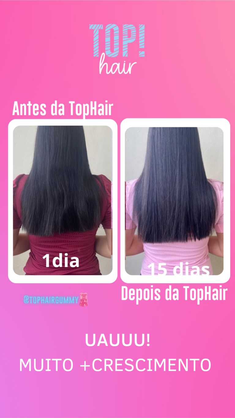 Top Hair Gummy Crescimento Acelerado 4571